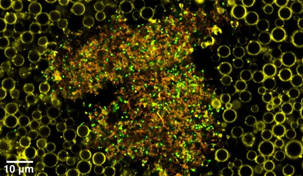 New ultrasound drug delivery system highly effective against bacterial biofilms